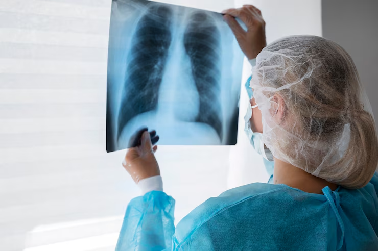 Common Injuries by MRI After a Car Accident