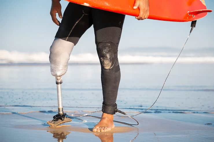 Common Injuries on Lake Moultrie