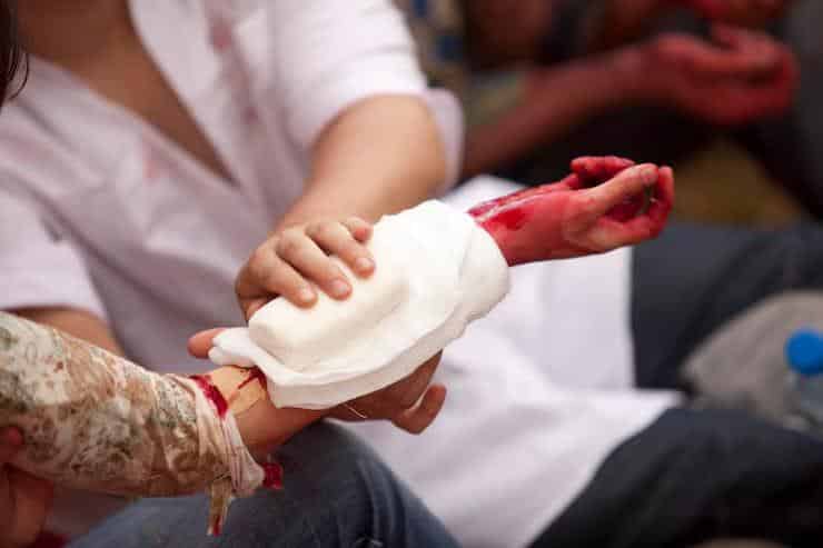 Burn Injuries Caused by Georgia Car Accidents
