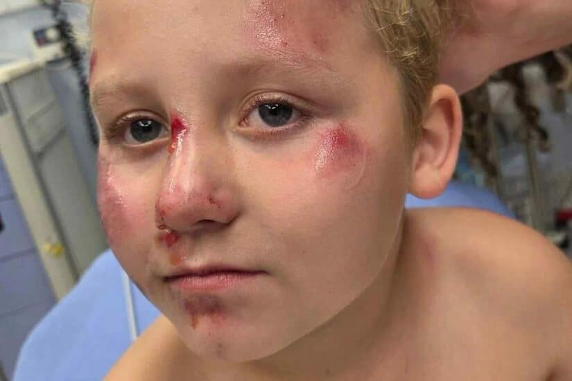 Image for Boy, Only 8 years old, Struck by Car in Hit-and-Run Accident in Georgia post