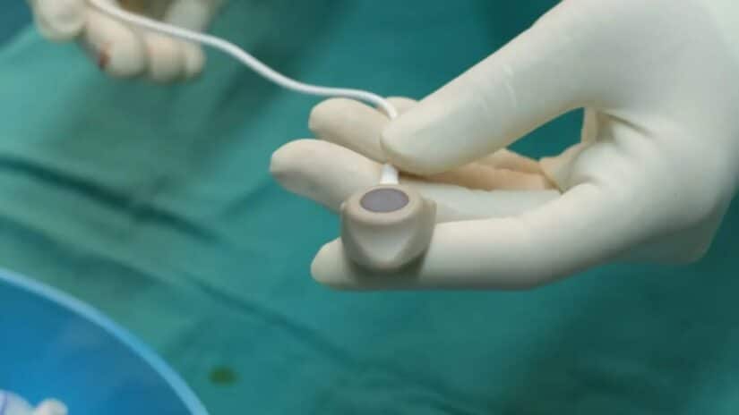 Bard-PowerPort-Under-Fire-for-Dangerous-Defects_-2025–2026-Lawsuit-Updates.